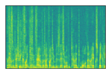 An audio spectrogram.