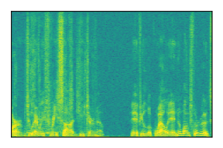 An audio spectrogram.