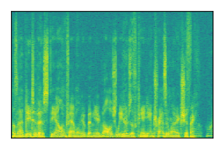 An audio spectrogram.