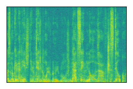 An audio spectrogram.