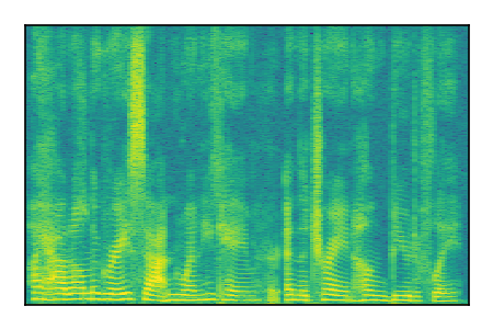 An audio spectrogram.