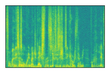An audio spectrogram.