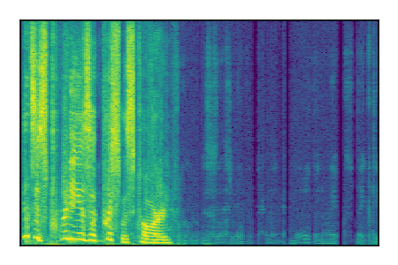 An audio spectrogram.