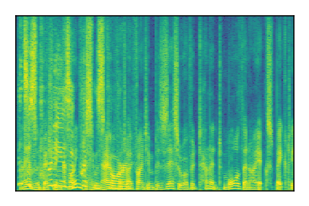 An audio spectrogram.