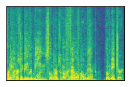 An audio spectrogram.