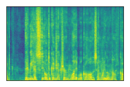 An audio spectrogram.