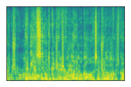 An audio spectrogram.