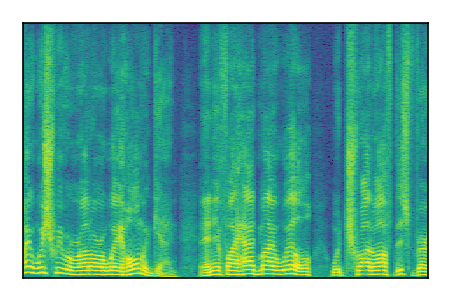 An audio spectrogram.