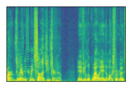 An audio spectrogram.