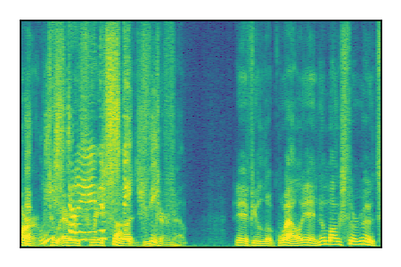 An audio spectrogram.