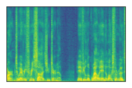 An audio spectrogram.
