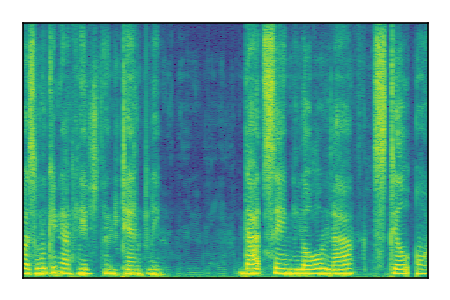 An audio spectrogram.