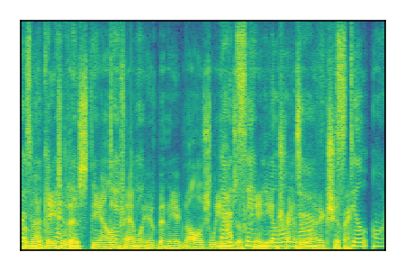 An audio spectrogram.