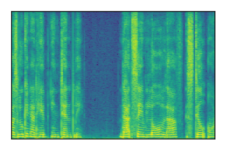 An audio spectrogram.