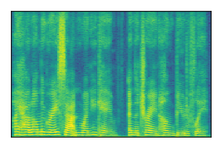 An audio spectrogram.