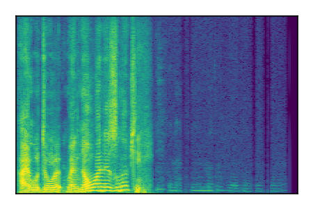An audio spectrogram.