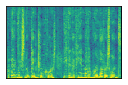 An audio spectrogram.