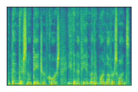 An audio spectrogram.