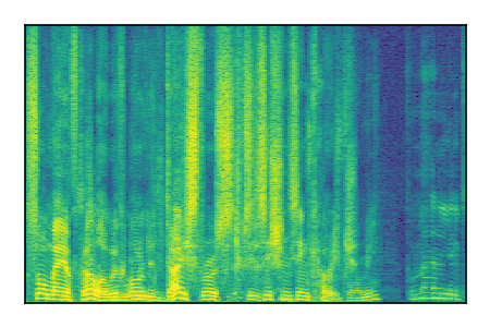 An audio spectrogram.