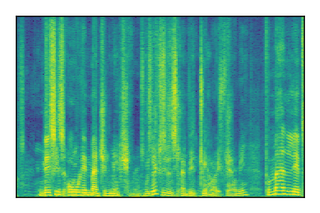 An audio spectrogram.