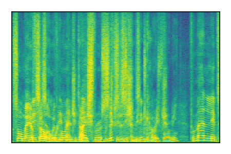 An audio spectrogram.