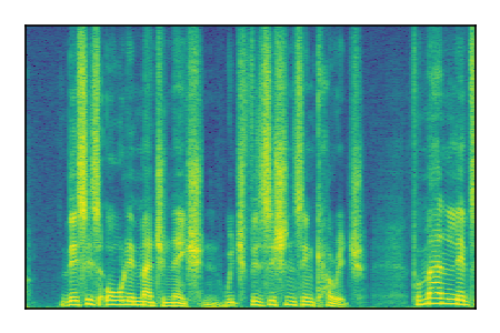 An audio spectrogram.