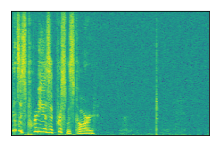 An audio spectrogram.