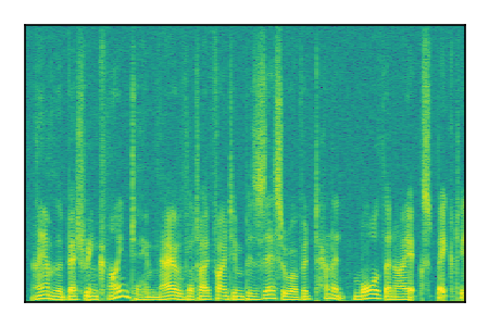 An audio spectrogram.