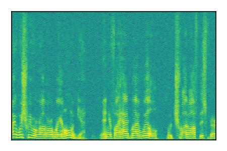 An audio spectrogram.