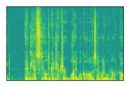 An audio spectrogram.