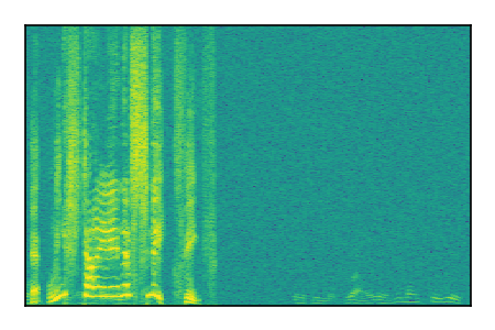 An audio spectrogram.