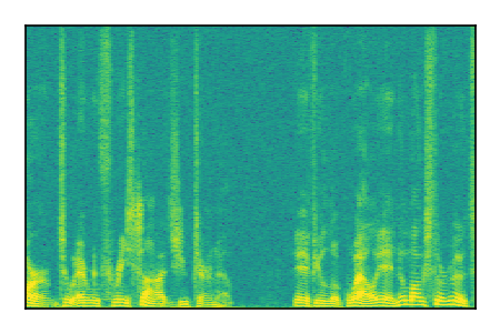 An audio spectrogram.