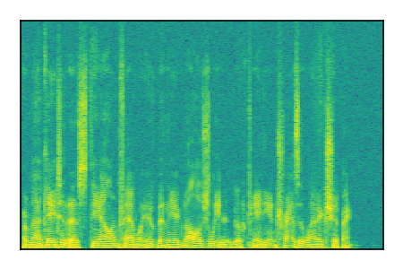 An audio spectrogram.