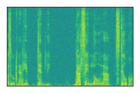An audio spectrogram.