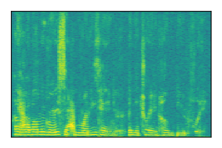 An audio spectrogram.