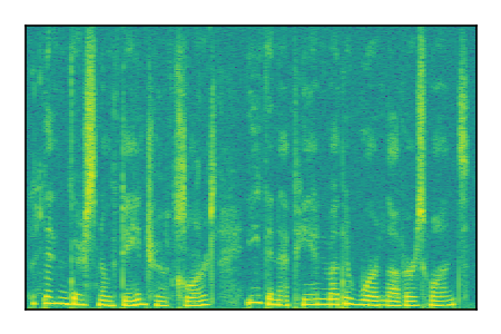An audio spectrogram.