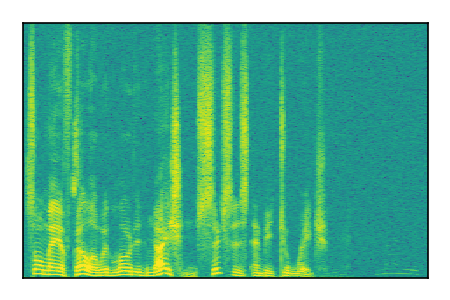 An audio spectrogram.