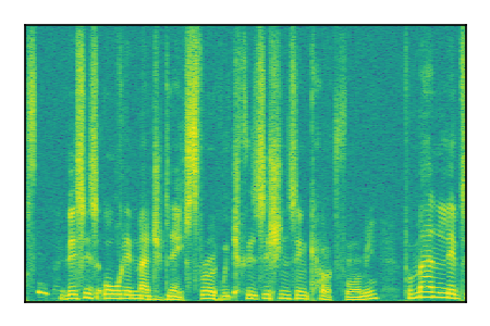 An audio spectrogram.