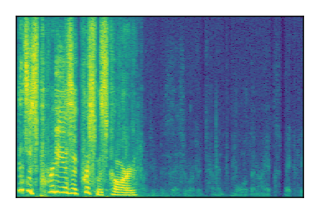 An audio spectrogram.