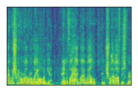 An audio spectrogram.