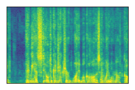 An audio spectrogram.