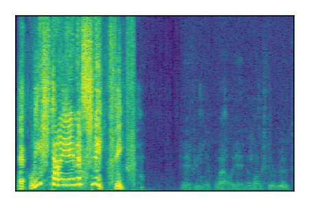 An audio spectrogram.