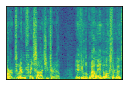 An audio spectrogram.