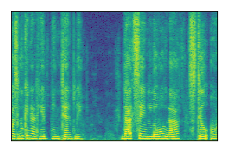 An audio spectrogram.