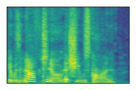 An audio spectrogram.