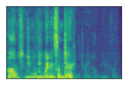 An audio spectrogram.