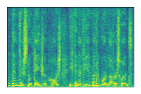 An audio spectrogram.