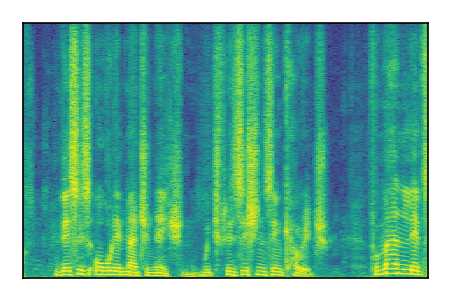 An audio spectrogram.