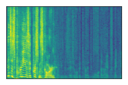 An audio spectrogram.