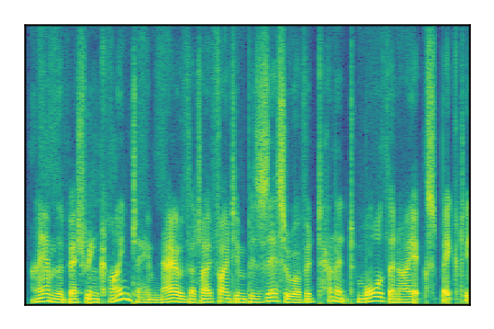 An audio spectrogram.